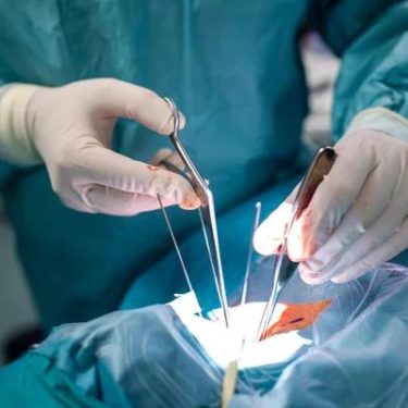 What to Expect from Breast Reconstruction Surgery Near Me